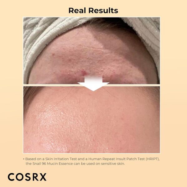 Best COSRX Snail Mucin 96 Essence – Korean Hydrating Serum - Image 2